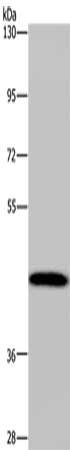 Gel: 6%SDS-PAGE, Lysate: 40 μg, Lane: Human hepatocellular carcinoma tissue, Primary antibody: CYP1A2 Antibody(CYP1A2 Antibody) at dilution 1/440, Secondary antibody: Goat anti rabbit IgG at 1/8000 dilution, Exposure time: 3 minutesRabbit anti-Human CYP1A2 Polyclonal Antibody