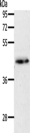 Gel: 10%SDS-PAGE, Lysate: 40 μg, Lane: Mouse brain tissue, Primary antibody: MAP2K1 Antibody(MAP2K1 Antibody) at dilution 1/450, Secondary antibody: Goat anti rabbit IgG at 1/8000 dilution, Exposure time: 1 minute