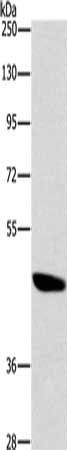 Gel: 8%SDS-PAGE, Lysate: 40 μg, Lane: A172 cells, Primary antibody: BRS3 Antibody(BRS3 Antibody) at dilution 1/500, Secondary antibody: Goat anti rabbit IgG at 1/8000 dilution, Exposure time: 20 seconds