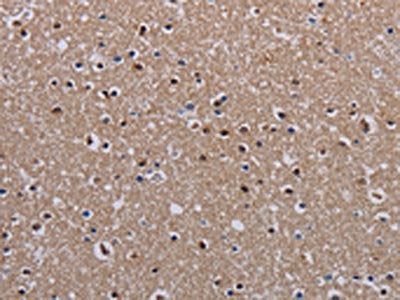 The image on the left is immunohistochemistry of paraffin-embedded Human brain  tissue using MECP2 Antibody(MECP2 Antibody) at dilution 1/60, on the right is treated with fusion protein. (Original magnification: ×200)