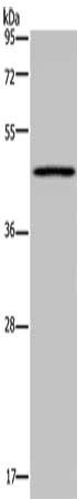 Gel: 8%SDS-PAGE, Lysate: 40 μg, Lane: Mouse lung tissue, Primary antibody: MECP2 Antibody(MECP2 Antibody) at dilution 1/300, Secondary antibody: Goat anti rabbit IgG at 1/8000 dilution, Exposure time: 3 minutes
