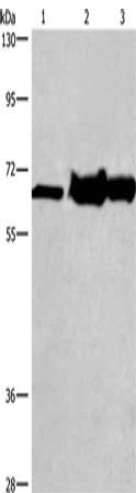 Gel: 10%SDS-PAGE, Lysate: 40 μg, Lane 1-3: 231 cells, mouse kidney tissue, Mouse liver tissue, Primary antibody: CHDH Antibody(CHDH Antibody) at dilution 1/500, Secondary antibody: Goat anti rabbit IgG at 1/8000 dilution, Exposure time: 30 secondsRabbit anti-Human CHDH Polyclonal Antibody
