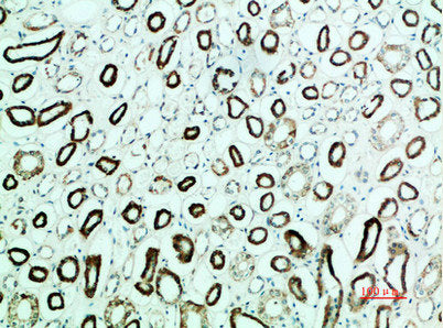 Immunohistochemical analysis of paraffin-embedded human-kidney, antibody was diluted at 1:200Rabbit anti-Human PTH1R Polyclonal Antibody