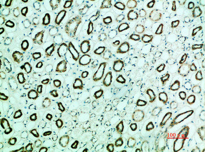 Immunohistochemical analysis of paraffin-embedded human-kidney, antibody was diluted at 1:200Rabbit anti-Human PTH1R Polyclonal Antibody