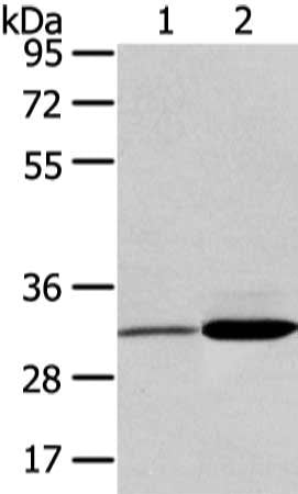 Gel: 8%SDS-PAGE, Lysate: 40 μg, Lane 1-2: Human fetal brain tissue and hela cell, Primary antibody: SDCBP Antibody(SDCBP Antibody) at dilution 1/450 dilution, Secondary antibody: Goat anti rabbit IgG at 1/8000 dilution, Exposure time: 3 secondsRabbit anti-Human SDCBP Polyclonal Antibody