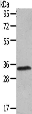 Gel: 8%SDS-PAGE,Lysate: 40 μg,,Primary antibody: UCP3 Antibody(UCP3 Antibody) at dilution 1/200 dilution,Secondary antibody: Goat anti rabbit IgG at 1/8000 dilution,Exposure time: 1 minuteRabbit anti-Human UCP3 Polyclonal Antibody