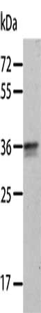 Gel: 10%SDS-PAGE, Lysate: 40 μg, Lane: A549 cells, Primary antibody: ANXA8 Antibody(ANXA8 Antibody) at dilution 1/300, Secondary antibody: Goat anti rabbit IgG at 1/8000 dilution, Exposure time: 2 minutesRabbit anti-Human ANXA8 Polyclonal Antibody