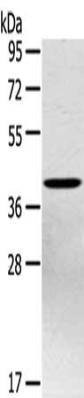 Gel: 8%SDS-PAGE, Lysate: 40 μg, Lane: Hepg2 cells, Primary antibody: PTX3 Antibody(PTX3 Antibody) at dilution 1/400, Secondary antibody: Goat anti rabbit IgG at 1/8000 dilution, Exposure time: 40 secondsRabbit anti-Human PTX3 Polyclonal Antibody