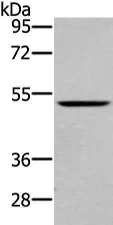 Gel: 8%SDS-PAGE, Lysate: 40 μg, Lane: Mouse lung tissue, Primary antibody: WASF2 Antibody(WASF2 Antibody) at dilution 1/200 dilution, Secondary antibody: Goat anti rabbit IgG at 1/8000 dilution, Exposure time: 1 minuteRabbit anti-Human WASF2 Polyclonal Antibody