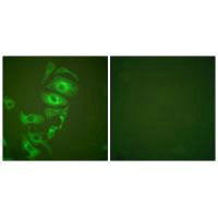 Immunofluorescence analysis of HepG2 cells, using keratin 17 antibody.