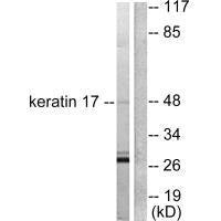 Western blot analysis of extracts from HuvEc cells, using keratin 17 antibody.
