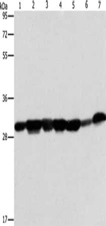 Gel: 10%SDS-PAGE, Lysate: 40 μg, Lane 1-7: Human placenta tissue, A549 cells, mouse brain tissue, hepG2 cells, Raji cells, human fetal liver tissue, hela cells, Primary antibody: AK2 Antibody(AK2 Antibody) at dilution 1/300, Secondary antibody: Goat anti rabbit IgG at 1/8000 dilution, Exposure time: 20 secondsRabbit anti-Human AK2 Polyclonal Antibody