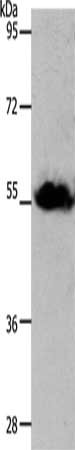 Gel: 10+12%SDS-PAGE, Lysate: 30 μg, Lane: Human liver cancer tissue, Primary antibody: SLC1A4 Antibody(SLC1A4 Antibody) at dilution 1/1250, Secondary antibody: Goat anti rabbit IgG at 1/8000 dilution, Exposure time: 20 secondsRabbit anti-Human SLC1A4 Polyclonal Antibody
