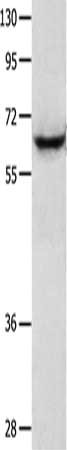 Gel: 10%SDS-PAGE, Lysate: 30 μg, Lane: Jurkat cells, Primary antibody: KRT2 Antibody(KRT2 Antibody) at dilution 1/450, Secondary antibody: Goat anti rabbit IgG at 1/8000 dilution, Exposure time: 45 seconds