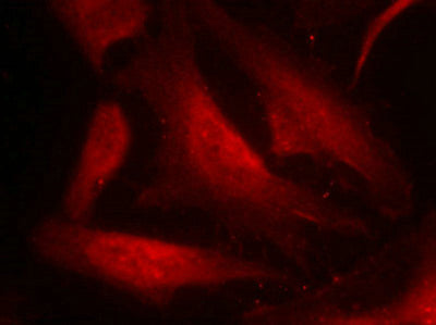 Immunofluorescence staining of methanol-fixed Hela cells using cdc25C(Phospho-Ser216) Antibody.Rabbit anti-Human CDC25C Polyclonal Antibody