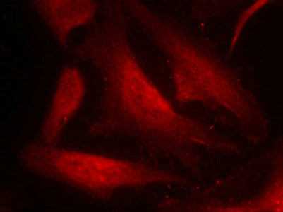Immunofluorescence staining of methanol-fixed Hela cells using cdc25C(Phospho-Ser216) Antibody.Rabbit anti-Human CDC25C Polyclonal Antibody