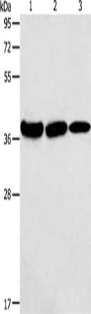 Gel: 10%SDS-PAGE, Lysate: 40 μg, Lane 1-3: Mouse kidney tissue, human testis tissue, Human thyroid cancer tissue, Primary antibody: AGA Antibody(AGA Antibody) at dilution 1/100, Secondary antibody: Goat anti rabbit IgG at 1/8000 dilution, Exposure time: 10 secondsRabbit anti-Human AGA Polyclonal Antibody