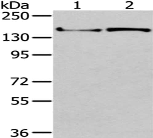 Gel: 6%SDS-PAGE,Lysate: 40 μg,Lane 1-2: MCF7 cells, 293T cells,Primary antibody: WNK3 Antibody(WNK3  Antibody) at dilution 1/200 dilution,Secondary antibody: Goat anti rabbit IgG at 1/8000 dilution,Exposure time: 3 minutesRabbit anti-Human WNK3 Polyclonal Antibody