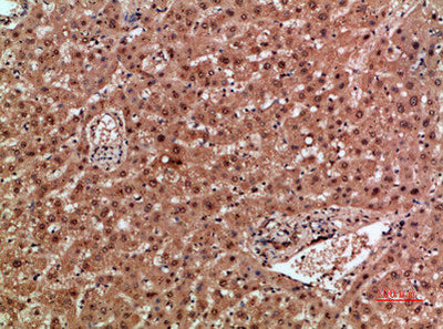 Immunohistochemical analysis of paraffin-embedded human-liver, antibody was diluted at 1:200Rabbit anti-Human NOX1 Polyclonal Antibody