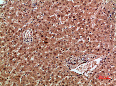 Immunohistochemical analysis of paraffin-embedded human-liver, antibody was diluted at 1:200Rabbit anti-Human NOX1 Polyclonal Antibody