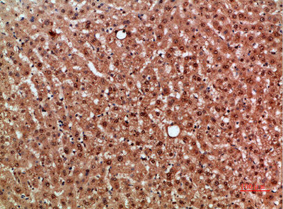 Immunohistochemical analysis of paraffin-embedded human-liver, antibody was diluted at 1:200Rabbit anti-Human NOX1 Polyclonal Antibody