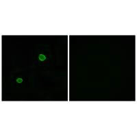 Immunofluorescence analysis of MCF-7 cells, using APOL4 antibody.Rabbit anti-Human APOL4 Polyclonal Antibody
