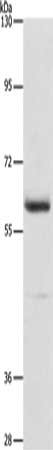 Gel: 10%SDS-PAGE, Lysate: 40 μg, Lane: Mouse thymus tissue, Primary antibody: AIFM3 Antibody(AIFM3 Antibody) at dilution 1/240, Secondary antibody: Goat anti rabbit IgG at 1/8000 dilution, Exposure time: 5 secondsRabbit anti-Human AIFM3 Polyclonal Antibody