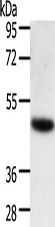 Gel: 10%SDS-PAGE, Lysate: 40 μg, Lane: Human lymphoma tissue, Primary antibody: TRAF1 Antibody(TRAF1 Antibody) at dilution 1/350, Secondary antibody: Goat anti rabbit IgG at 1/8000 dilution, Exposure time: 1 secondRabbit anti-Human TRAF1 Polyclonal Antibody