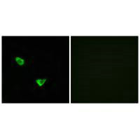 Immunofluorescence analysis of MCF-7 cells, using CHSS2 antibody.