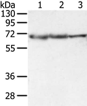 Gel: 8%SDS-PAGE, Lysate: 40 μg, Lane 1-3: Lncap, hepg2 and A431 cell, Primary antibody: DLAT Antibody(DLAT Antibody) at dilution 1/400 dilution, Secondary antibody: Goat anti rabbit IgG at 1/8000 dilution, Exposure time: 3 secondsRabbit anti-Human DLAT Polyclonal Antibody