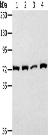 Gel: 10%SDS-PAGE, Lysate: 30 μg, Lane: 293T cells, Primary antibody: CAPN1 Antibody(CAPN1 Antibody) at dilution 1/450, Secondary antibody: Goat anti rabbit IgG at 1/8000 dilution, Exposure time: 1 minute