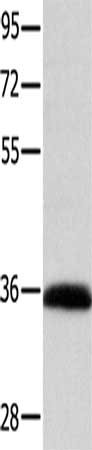 Gel: 10%SDS-PAGE, Lysate: 40 μg, Lane: A549 cells, Primary antibody: CCND1 Antibody(CCND1 Antibody) at dilution 1/400, Secondary antibody: Goat anti rabbit IgG at 1/8000 dilution, Exposure time: 5 minutesRabbit anti-Human CCND1 Polyclonal Antibody