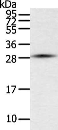 Gel: 12%SDS-PAGE, Lysate: 40 μg, Lane: Human placenta tissue, Primary antibody: TFPI2 Antibody(TFPI2 Antibody) at dilution 1/200 dilution, Secondary antibody: Goat anti rabbit IgG at 1/8000 dilution, Exposure time: 5 secondsRabbit anti-Human TFPI2 Polyclonal Antibody