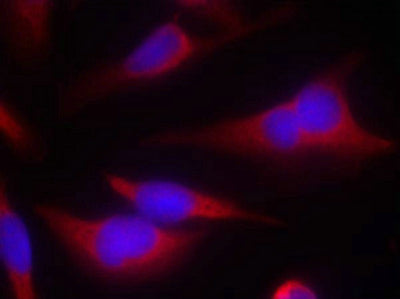 Immunofluorescence staining of methanol-fixed Hela cells using eIF2a(Ab-51) Antibody.Rabbit anti-Human EIF2S1 Polyclonal Antibody