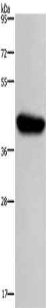 Gel: 8%SDS-PAGE, Lysate: 40 μg, Lane: 231 cells, Primary antibody: HIF1AN Antibody(HIF1AN Antibody) at dilution 1/250, Secondary antibody: Goat anti rabbit IgG at 1/8000 dilution, Exposure time: 20 secondsRabbit anti-Human HIF1AN Polyclonal Antibody