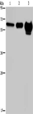 Gel: 8%SDS-PAGE, Lysate: 40 μg, Lane 1-3: 823 cells, mouse brain tissue, human fetal brain tissue, Primary antibody: MMP20 Antibody(MMP20 Antibody) at dilution 1/400, Secondary antibody: Goat anti rabbit IgG at 1/8000 dilution, Exposure time: 20 secondsRabbit anti-Human MMP20 Polyclonal Antibody