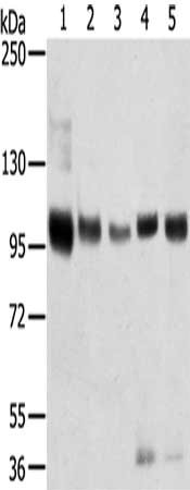 Gel: 6%SDS-PAGE, Lysate: 40 μg, Lane 1-5: Mouse brain tissue, human brain tissue, human prostate tissue, human fat tissue, Human placenta tissue, Primary antibody: SORT1 Antibody(SORT1 Antibody) at dilution 1/200, Secondary antibody: Goat anti rabbit IgG at 1/8000 dilution, Exposure time: 40 secondsRabbit anti-Human SORT1 Polyclonal Antibody