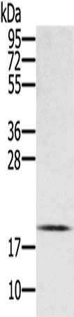 Gel: 12%SDS-PAGE, Lysate: 40 μg, Lane: Mouse heart tissue, Primary antibody: EID1 Antibody(EID1 Antibody) at dilution 1/300, Secondary antibody: Goat anti rabbit IgG at 1/8000 dilution, Exposure time: 3 minutesRabbit anti-Human EID1 Polyclonal Antibody
