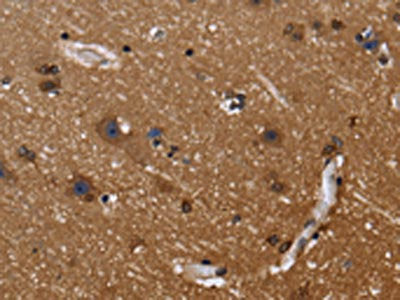The image on the left is immunohistochemistry of paraffin-embedded Human brain tissue using the antibody Antibody) at dilution 1/40, on the right is treated with fusion protein. (Original magnification: ×200)Rabbit anti-Human FGFR1OP Polyclonal Antibody
