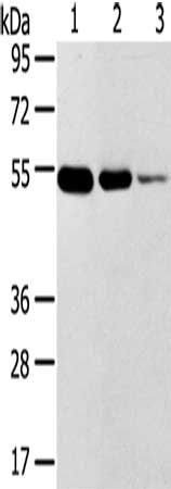 Gel: 8%SDS-PAGE, Lysate: 40 μg, Lane 1-3: Human thyroid tissue, Human esophagus cancer tissue, human normal rectum tissue, Primary antibody: TMPRSS11F Antibody(TMPRSS11F Antibody) at dilution 1/500, Secondary antibody: Goat anti rabbit IgG at 1/8000 dilution, Exposure time: 1 minuteRabbit anti-Human TMPRSS11F Polyclonal Antibody