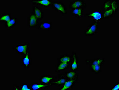 Immunofluorescent analysis of Hela cells using C1QTNF9B Antibody at dilution of 1:100 and Alexa Fluor 488-congugated AffiniPure Goat Anti-Rabbit IgG(H+L)