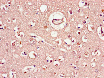 Immunohistochemistry of paraffin-embedded human brain tissue using the antibody at dilution of 1:100