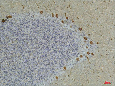 Immunohistochemical analysis of paraffin-embedded Human BrainTissue using Ghrelin Receptor Rabbit pAb diluted at 1:200.Rabbit anti-Human GHSR Polyclonal Antibody