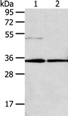 Gel: 8%SDS-PAGE, Lysate: 40 μg, Lane 1-2: Lo2 and huvec cell, Primary antibody: TNFAIP1 Antibody(TNFAIP1 Antibody) at dilution 1/200 dilution, Secondary antibody: Goat anti rabbit IgG at 1/8000 dilution, Exposure time: 40 secondsRabbit anti-Human TNFAIP1 Polyclonal Antibody