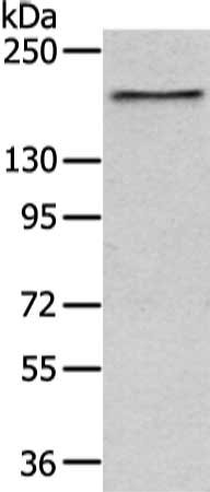 Gel: 6%SDS-PAGE, Lysate: 40 μg, Lane: A172 cell, Primary antibody: USP47 Antibody(USP47 Antibody) at dilution 1/400 dilution, Secondary antibody: Goat anti rabbit IgG at 1/8000 dilution, Exposure time: 30 secondsRabbit anti-Human USP47 Polyclonal Antibody