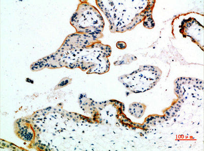 Immunohistochemical analysis of paraffin-embedded human-placenta, antibody was diluted at 1:200Rabbit anti-Human EDNRB Polyclonal Antibody
