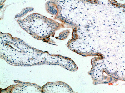 Immunohistochemical analysis of paraffin-embedded human-placenta, antibody was diluted at 1:200Rabbit anti-Human EDNRB Polyclonal Antibody