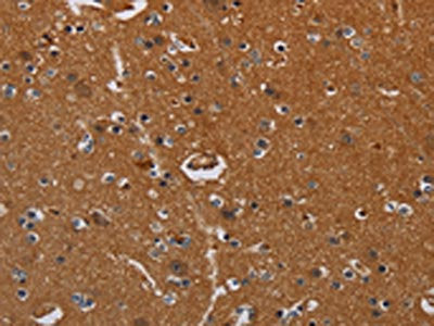 The image on the left is immunohistochemistry of paraffin-embedded Human brain  tissue using LRRC57 Antibody(LRRC57 Antibody) at dilution 1/40, on the right is treated with fusion protein. (Original magnification: ×200)