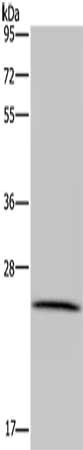 Gel: 10%SDS-PAGE, Lysate: 40 μg, Lane: HT29 cells, Primary antibody: LRRC57 Antibody(LRRC57 Antibody) at dilution 1/200, Secondary antibody: Goat anti rabbit IgG at 1/8000 dilution, Exposure time: 5 minutes