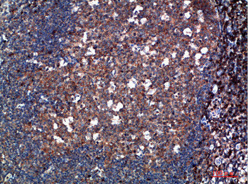 Immunohistochemical analysis of paraffin-embedded human-tonsil, antibody was diluted at 1:200Rabbit anti-Human TPSD1 Polyclonal Antibody